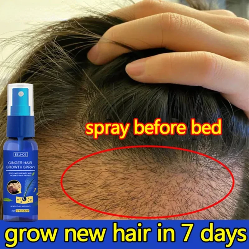 Hair Growth Spray Promote Fast - Perfume Zara recension och pris