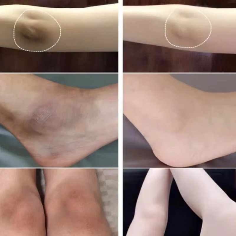 Body Whitening Cream Arms Thig - Perfume Zara recension och pris