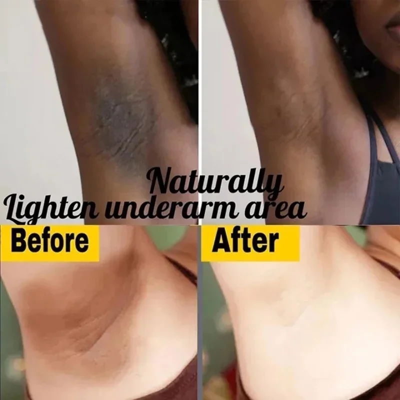 Brightening Cream For Intimate - Perfume Zara recension och pris
